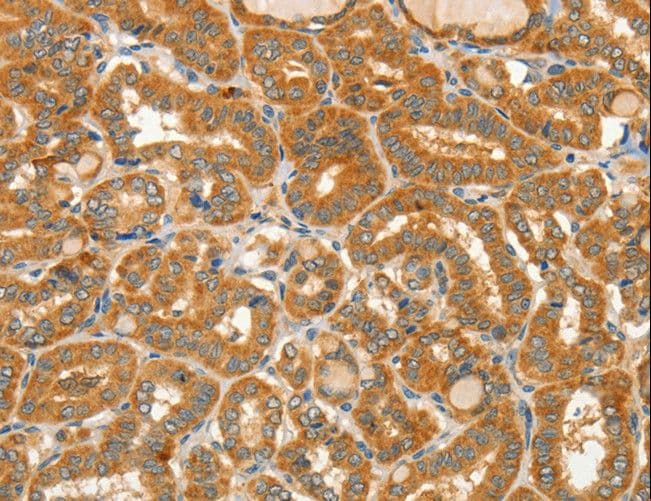 Polyclonal Rabbit anti-Human CIB1 / KIP Antibody (IHC)