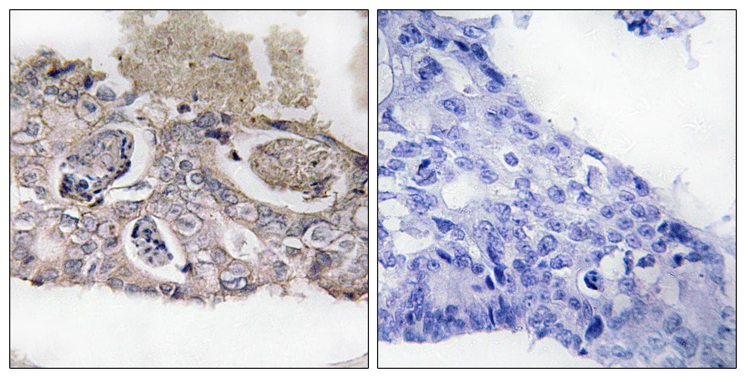 MARK2 Antibody (Ab-596)