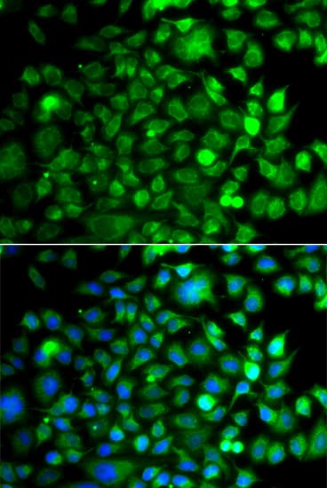 OSGEP Antibody