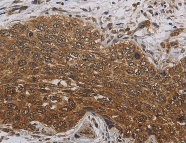 Dynactin 3 / DCTN3 Antibody