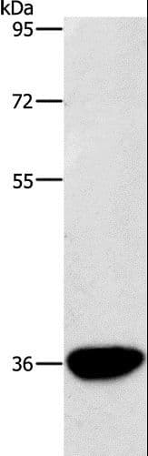 AKR1D1 Antibody
