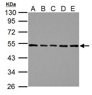 TUBB / Beta Tubulin Antibody