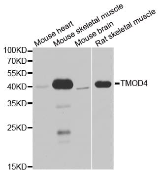 Polyclonal Rabbit anti-Human TMOD4 Antibody (IHC, IF, WB)