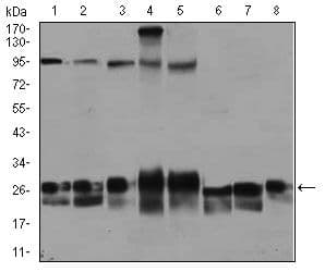 Monoclonal Mouse anti-Human RAB4A / RAB4 Antibody (clone 4E+11, IHC, WB)