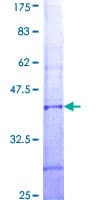 Human IMP5 Protein (Recombinant GST, N-terminus)