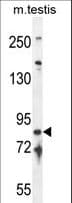 Polyclonal Rabbit anti-Human IFT81 Antibody (aa527-555, WB)