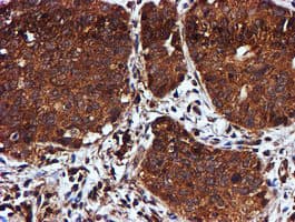 C1orf50 Antibody (clone OTI1C6)