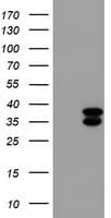 CYB5R3 / B5R Antibody (clone OTI1E8)