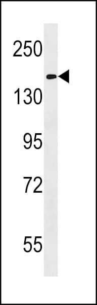 IHC-plus™ Polyclonal Rabbit anti-Human HEPHL1 Antibody (aa199-225, IHC, WB)