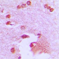 APBA2 Antibody (Internal)