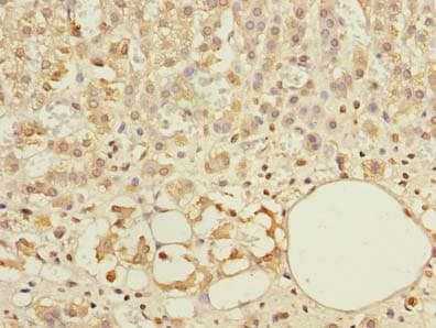 Polyclonal Rabbit anti-Human ABCF3 Antibody (IHC)