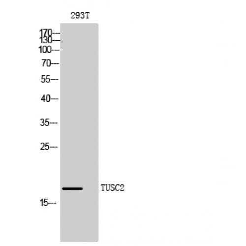 TUSC2 / FUS1 Antibody (10-90 aa, Internal)