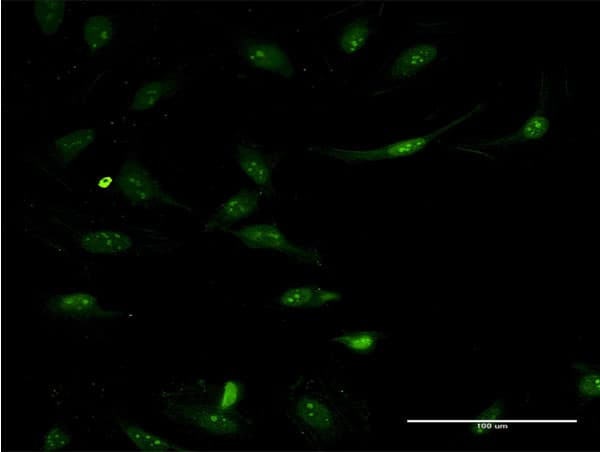 ASS1 / ASS Antibody (clone 2D2)
