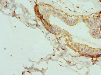 Polyclonal Rabbit anti-Human CPSF3L Antibody (IHC, WB)