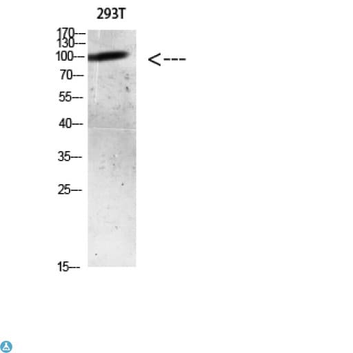 AR / Androgen Receptor Antibody
