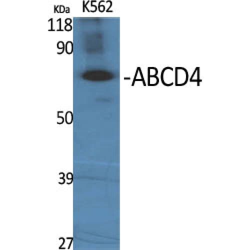 ABCD4 Antibody (80-160 aa, Internal)