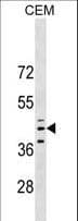 Polyclonal Rabbit anti-Human QPCT / QC Antibody (aa315-343, WB)