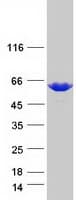 Human YARS / Tyrosyl-tRNA Synthetase Protein (Recombinant Myc-DDK (Flag))
