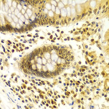 MDM2 Antibody