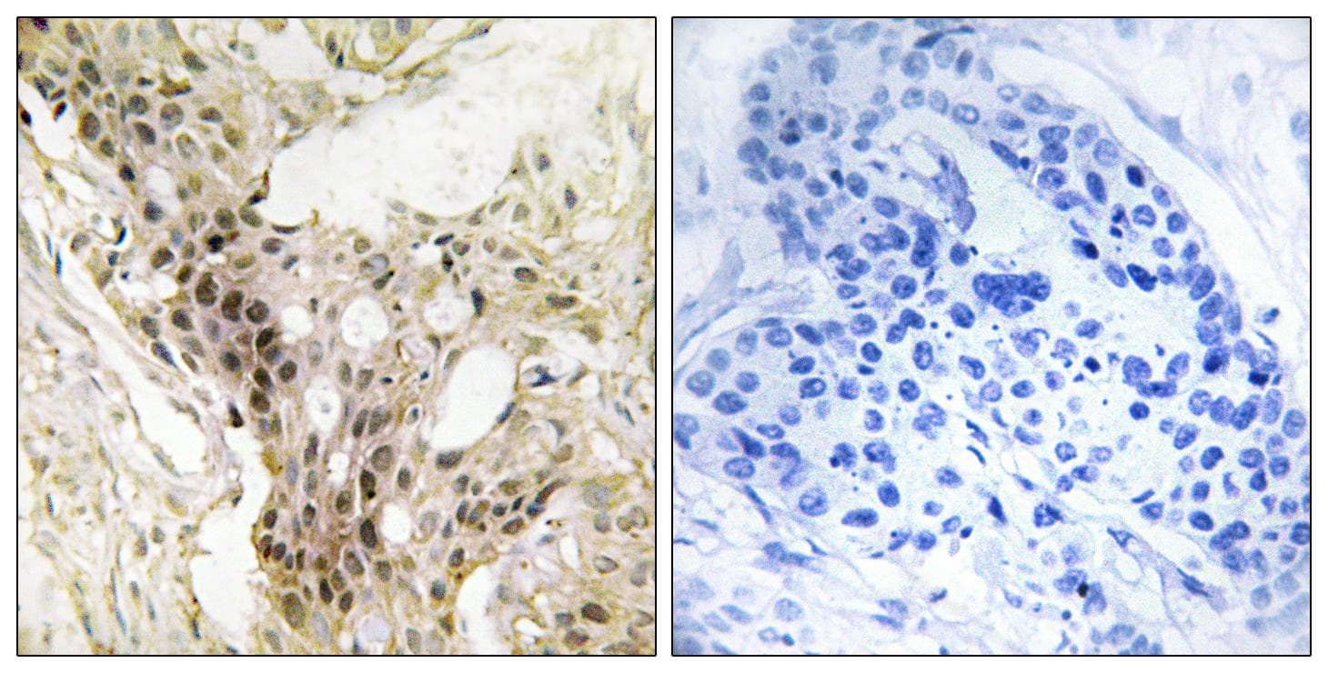 Polyclonal Rabbit anti-Human MED21 Antibody (IHC)
