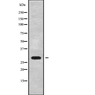 EIF3J Antibody