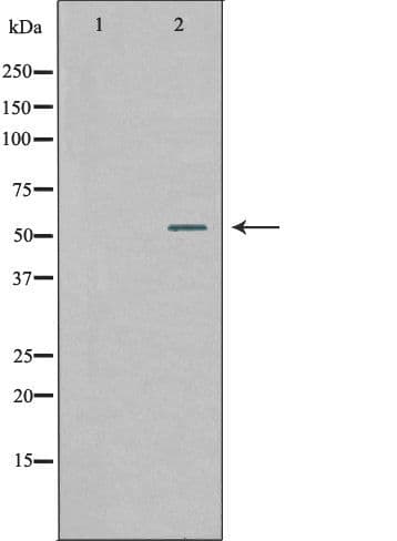 WASF2 / SCAR2 Antibody
