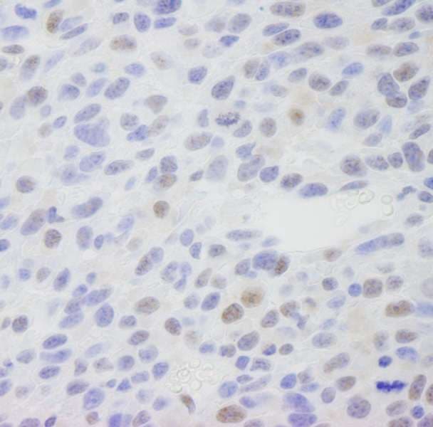 Polyclonal Rabbit anti-Human MED1 / TRAP220 Antibody (aa1525-C-term, IHC)