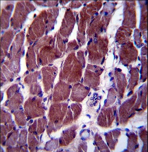 FIZ1 Antibody (aa376-405)