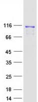 Human RAI14 Protein (Recombinant Myc-DDK (Flag))