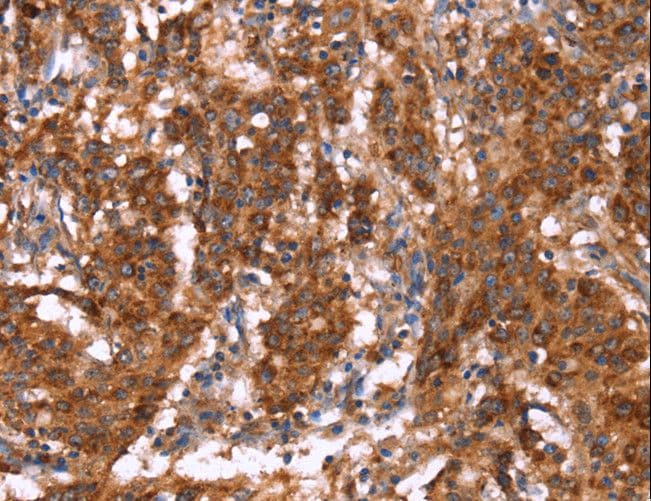 Polyclonal Rabbit anti-Human GAGE12I / GAGE7B Antibody (IHC)