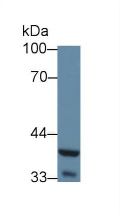 WNT5A Antibody (aa62-381)