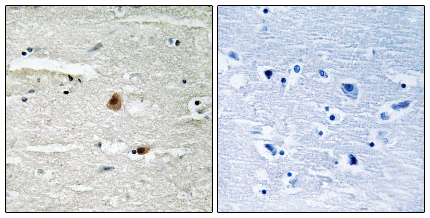 GPS1 / CSN1 Antibody
