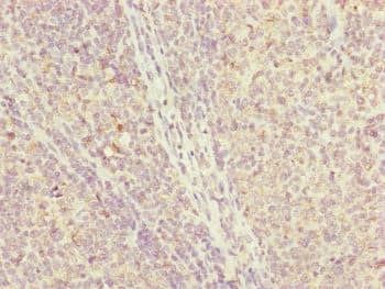 Polyclonal Rabbit anti-Human IL36A Antibody (IHC)