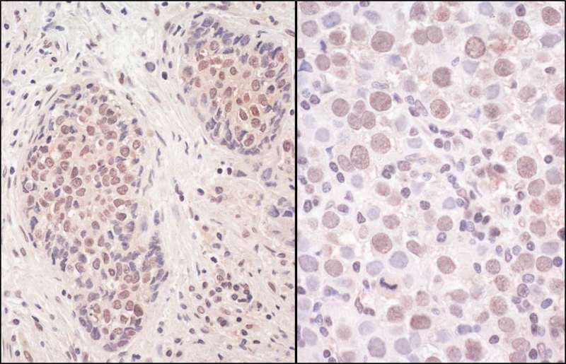 Polyclonal Rabbit anti-Human SMCHD1 Antibody (aa1955-2005, IHC, WB)