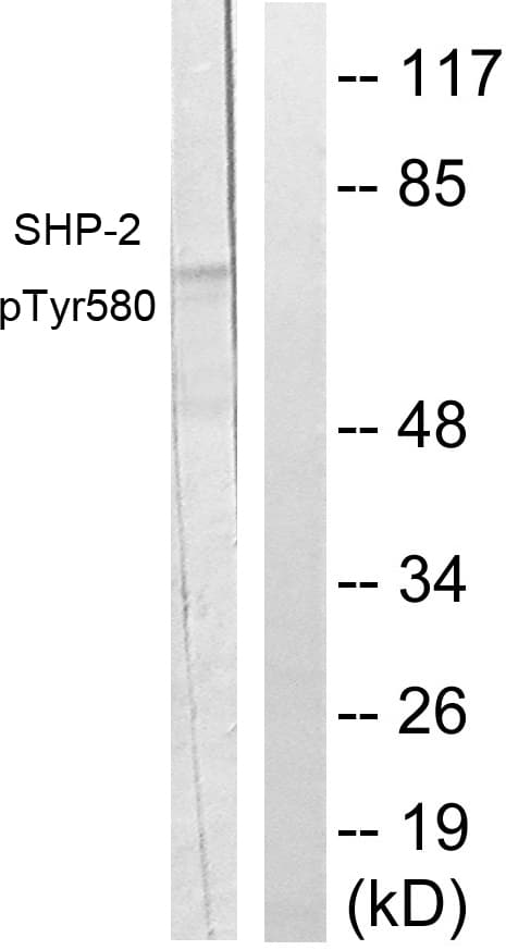 PTPN11 / SHP-2 / NS1 Antibody (phospho-Tyr580)