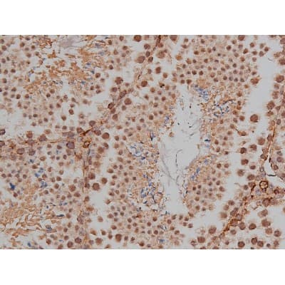 MAPT / Tau Antibody (phospho-Thr231)
