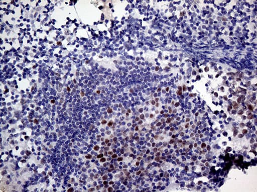 MLH1 Antibody (aa299-527, clone OTI4H6)
