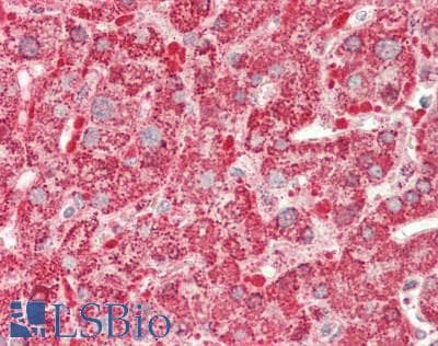 IHC-plus™ Polyclonal Rabbit anti-Human HADHB Antibody (IHC, IF, WB)