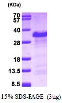 Human PAIP2 Protein (Recombinant His)