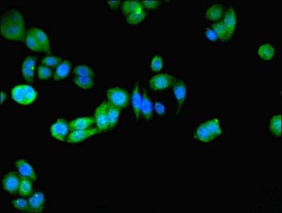 PRDX5 / Peroxiredoxin 5 Antibody (aa53-214)