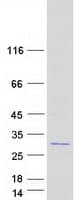 Human ACTR3C Protein (Recombinant Myc-DDK (Flag))