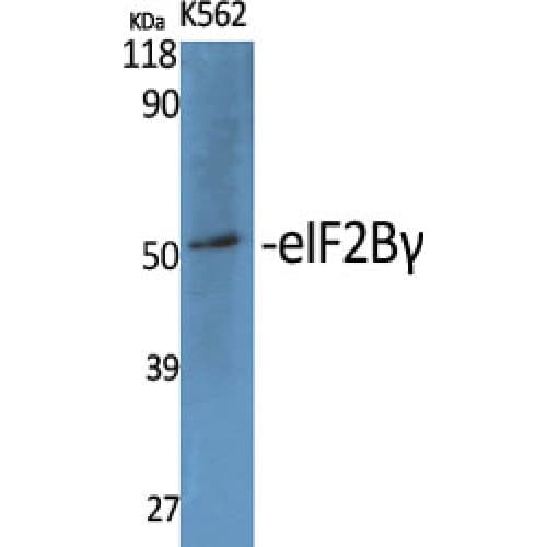 EIF2B3 Antibody (240-320 aa, Internal)