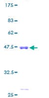 Human Prostaglandin D Synthase Protein (Recombinant GST)
