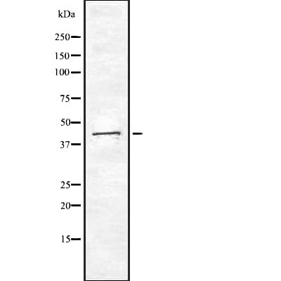 CKB / Creatine Kinase BB Antibody