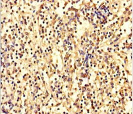ANKDD1A Antibody