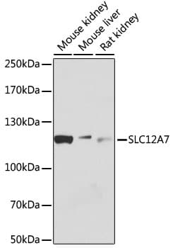 SLC12A7 / KCC4 Antibody