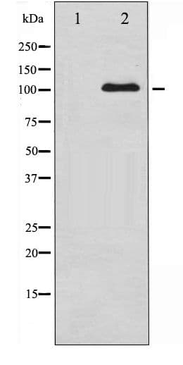Polyclonal Rabbit anti-Human GRIN1 / NMDAR1 Antibody (phospho-Ser890, IHC, IF, WB)