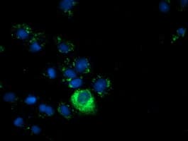 Alpha-Fetoprotein Antibody (clone OTI3G3)