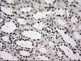 Monoclonal Mouse anti-Human GCK / Glucokinase Antibody (clone OTI3E3, IHC, IF, WB)
