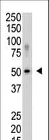 Polyclonal Rabbit anti-Human SENP5 Antibody (aa524-555, IHC, WB)